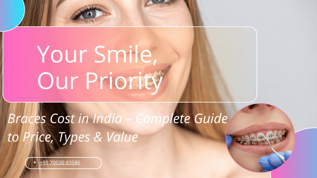 braces cost in India