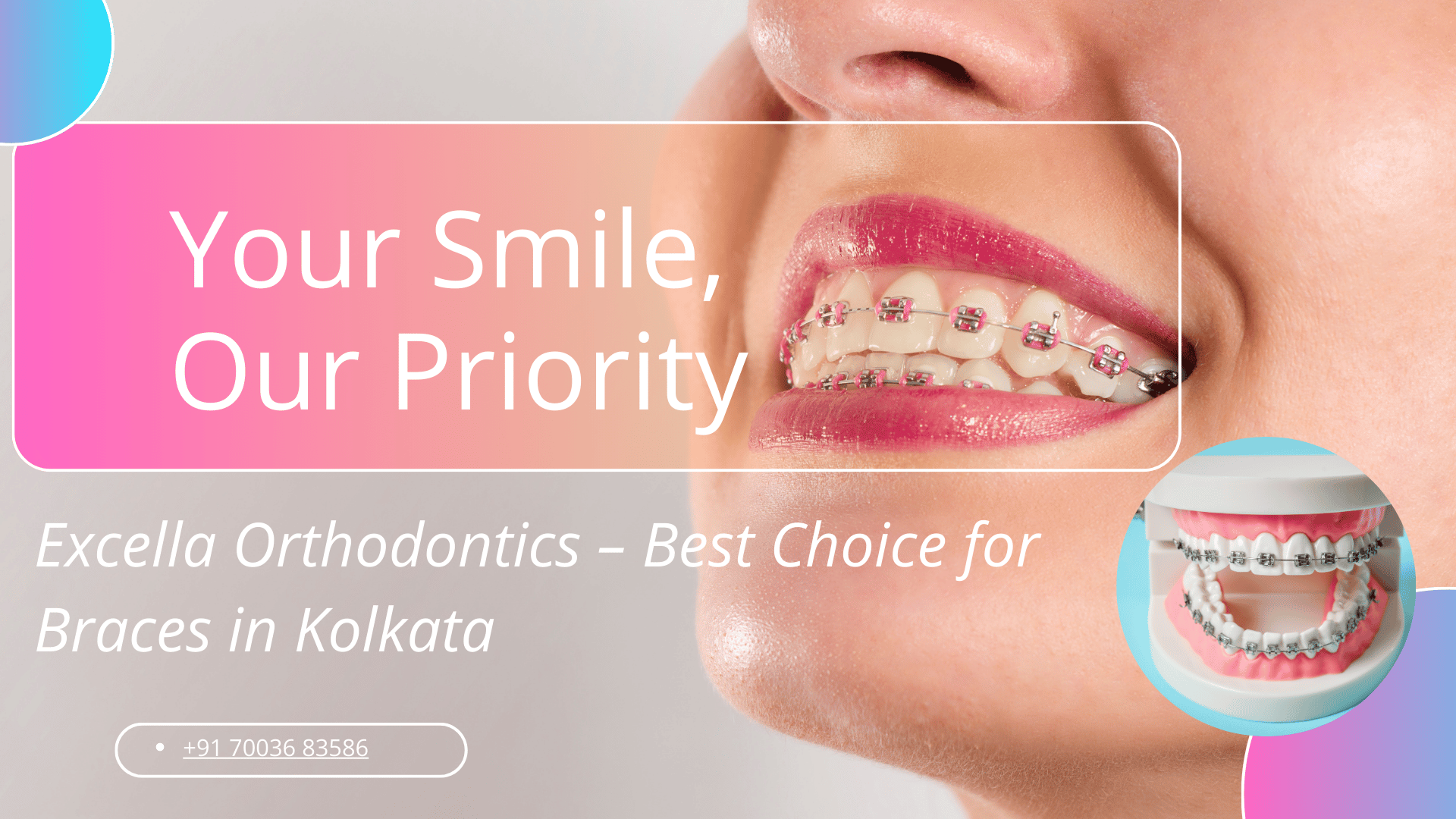 Braces in Kolkata