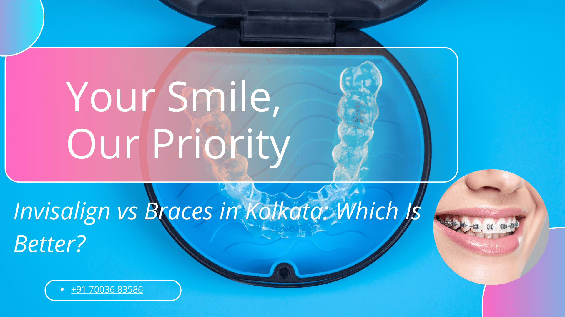 Invisalign vs Braces in Kolkata
