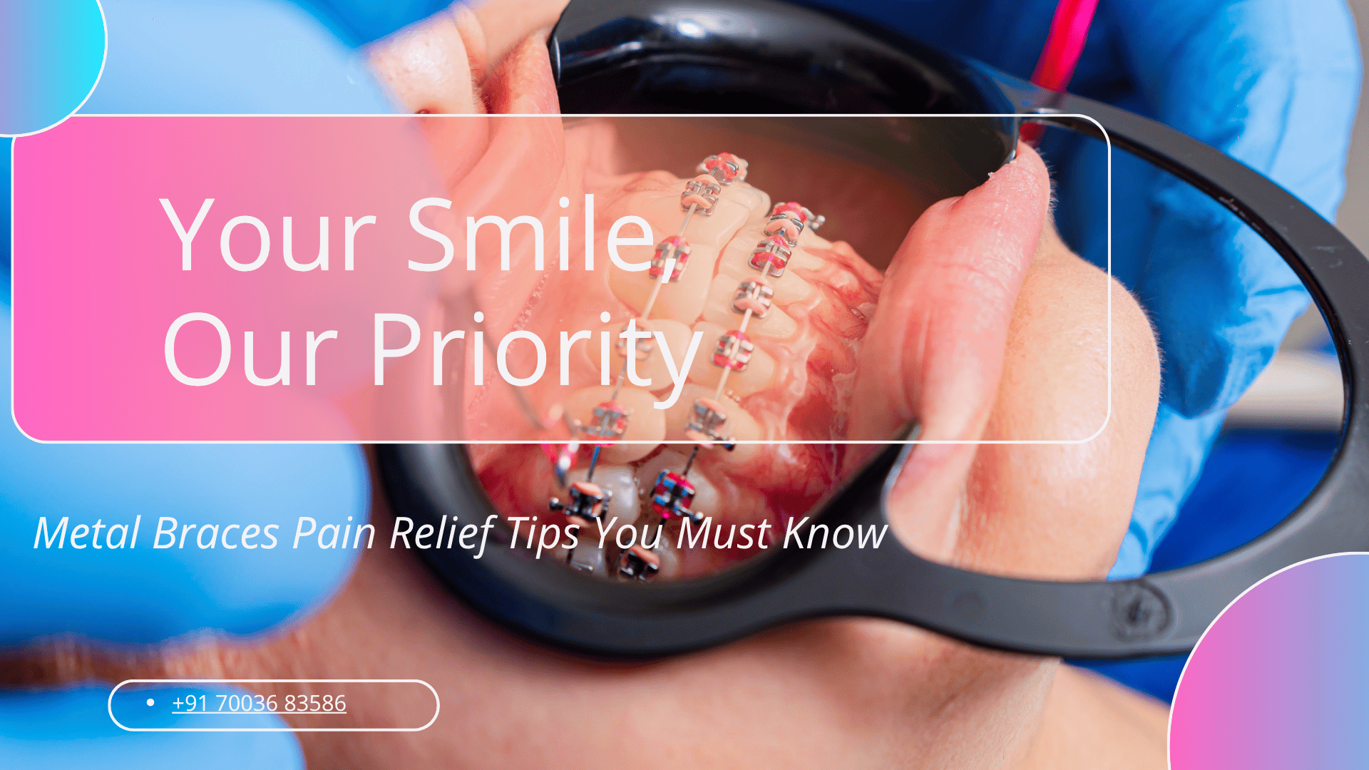 Metal Braces Pain Relief