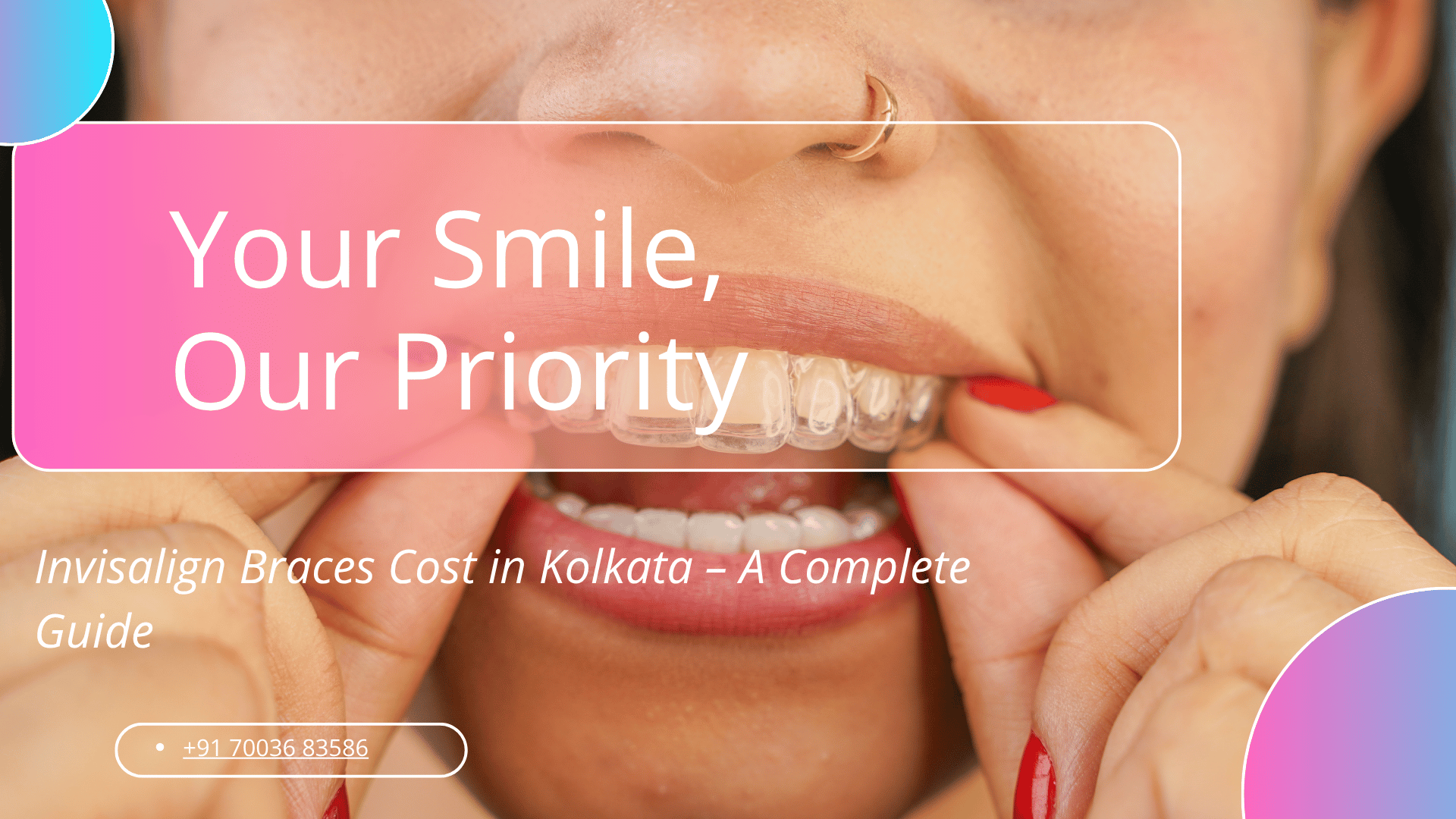 Invisalign Braces Cost in Kolkata