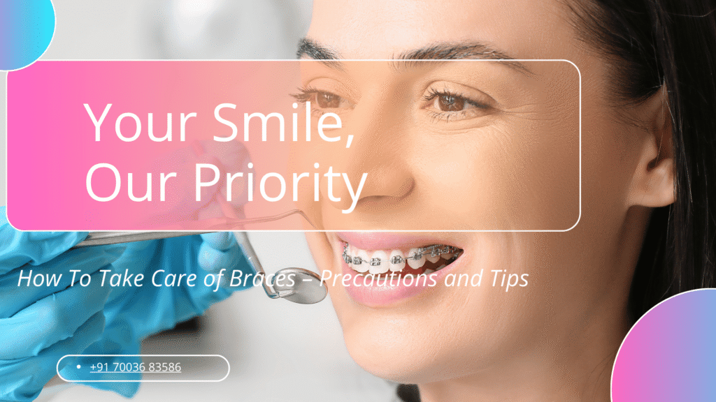How To Take Care of Braces