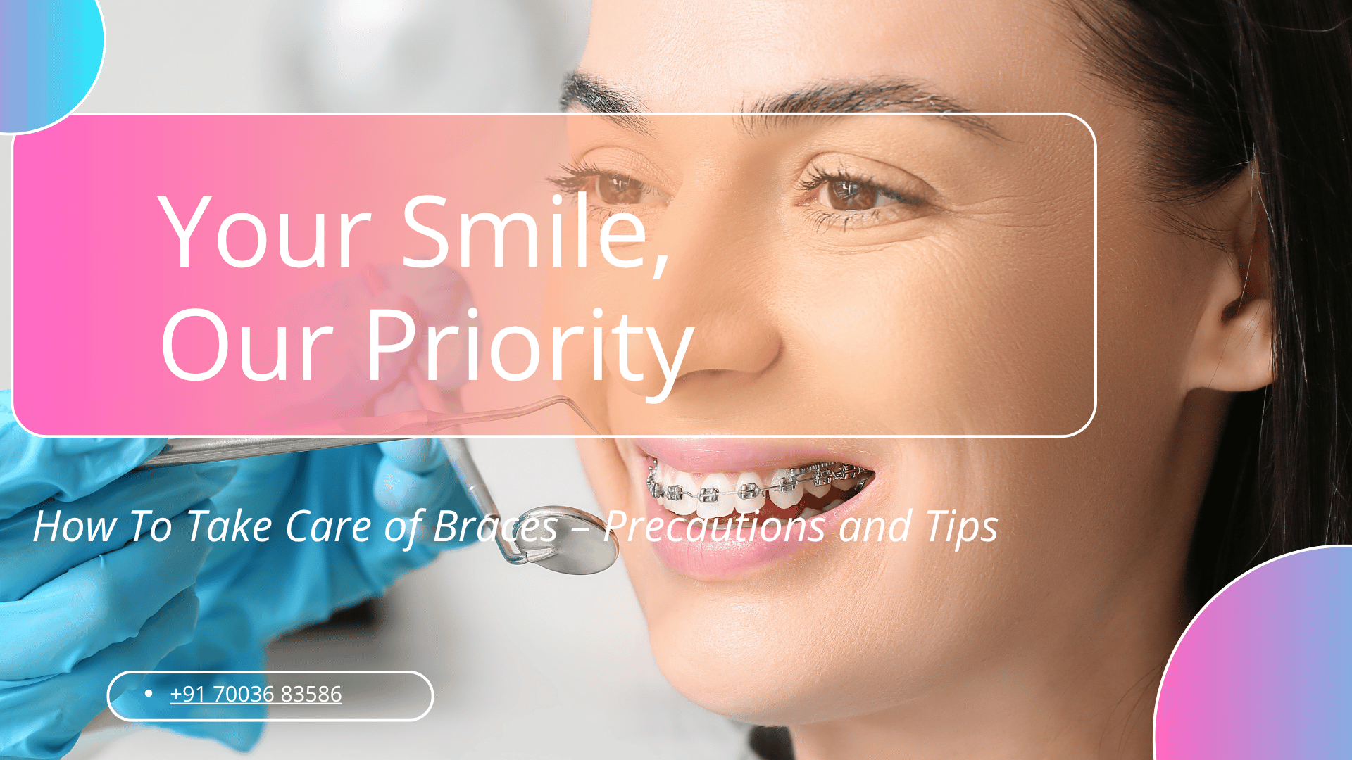 How To Take Care of Braces