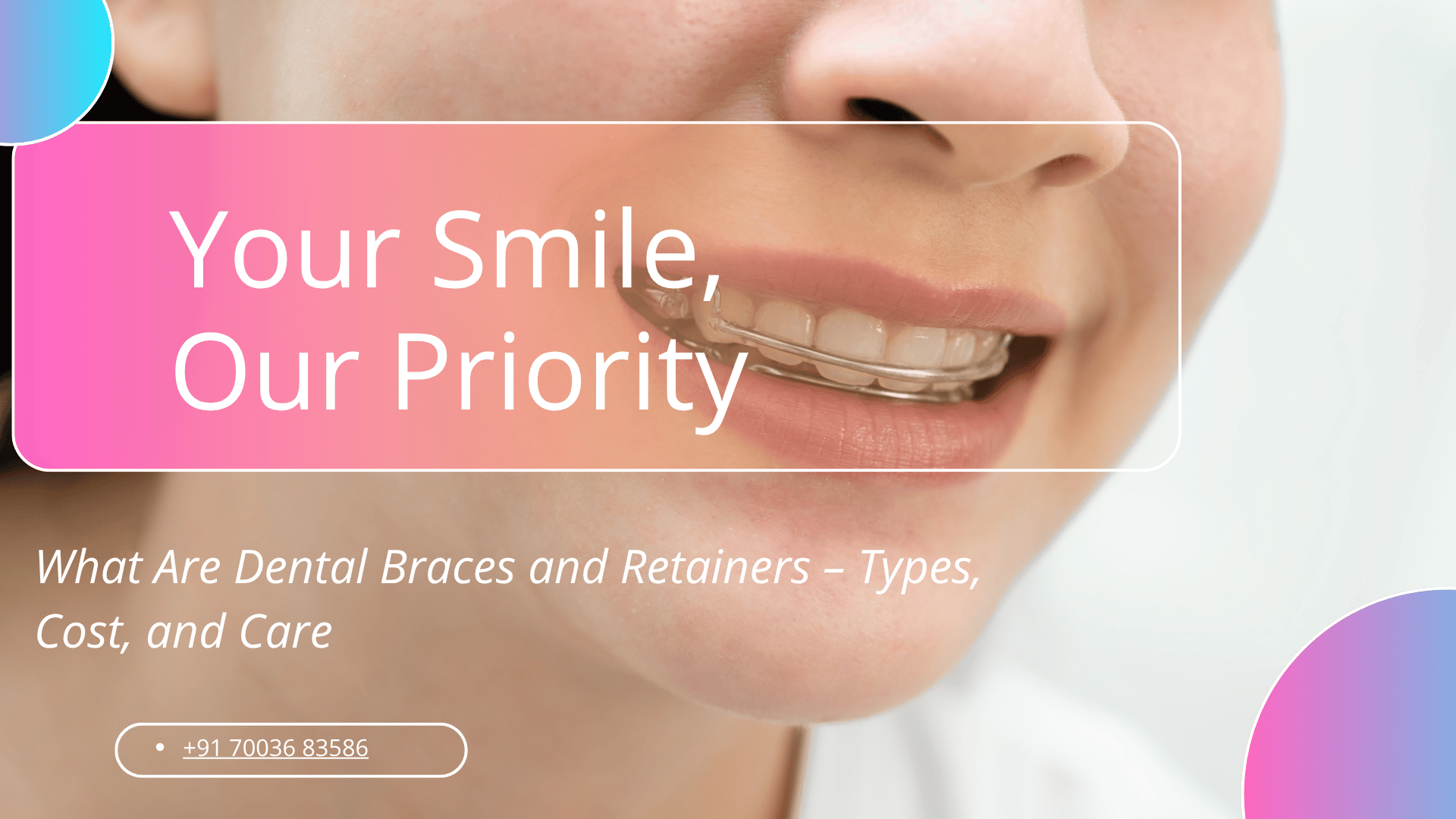 Dental Braces