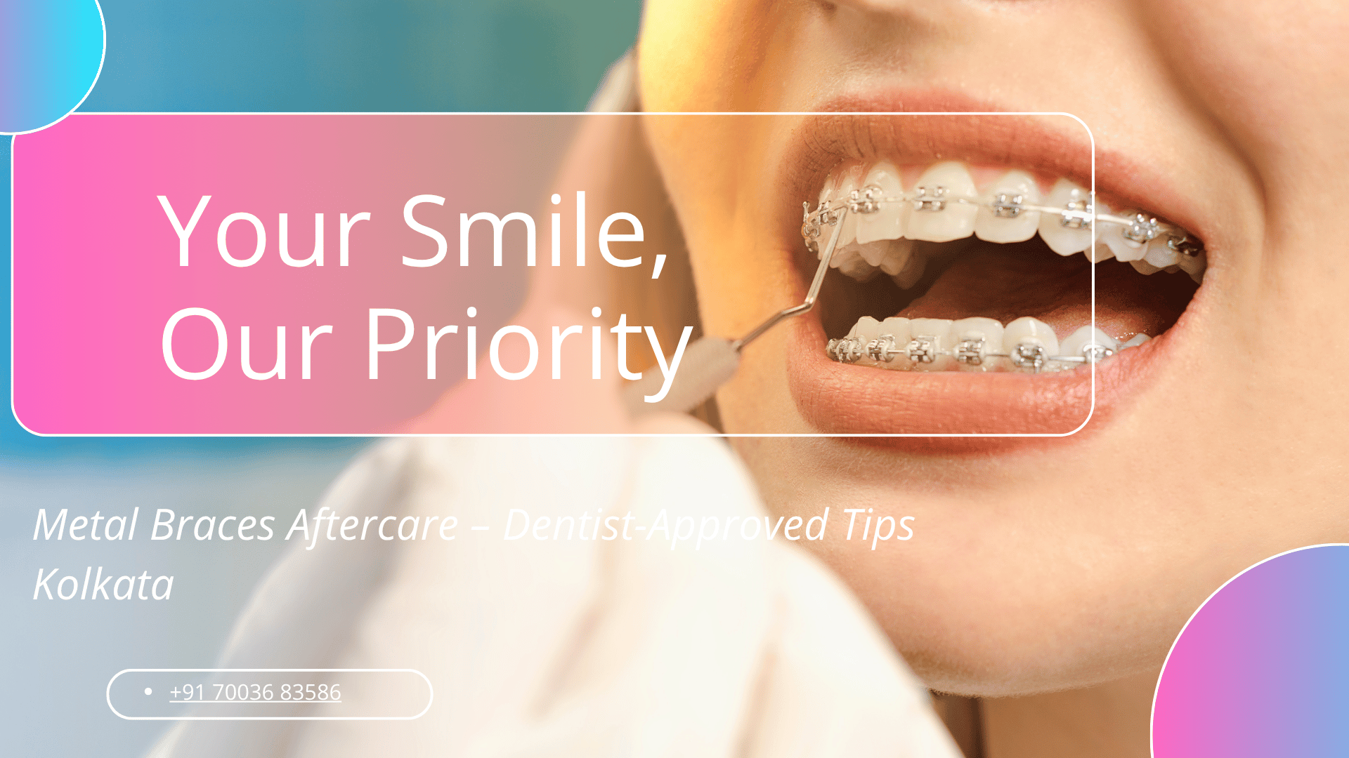 Metal Braces Aftercare