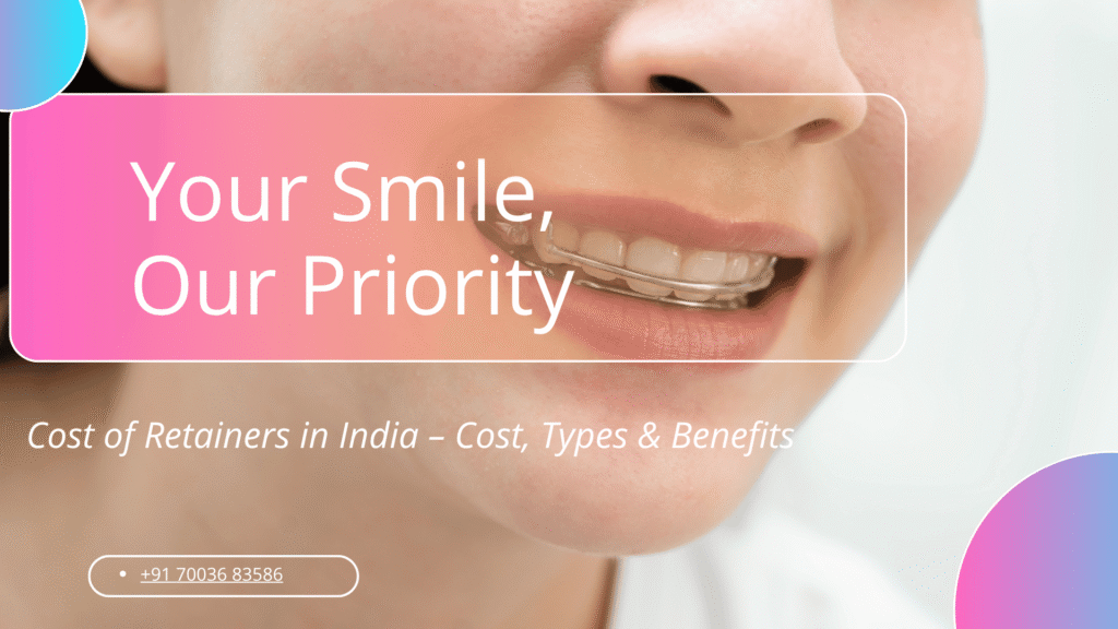 cost of retainers in india