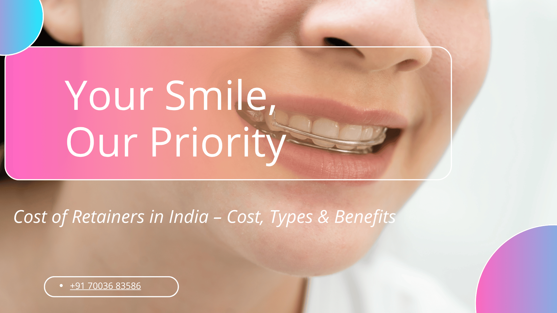 cost of retainers in india