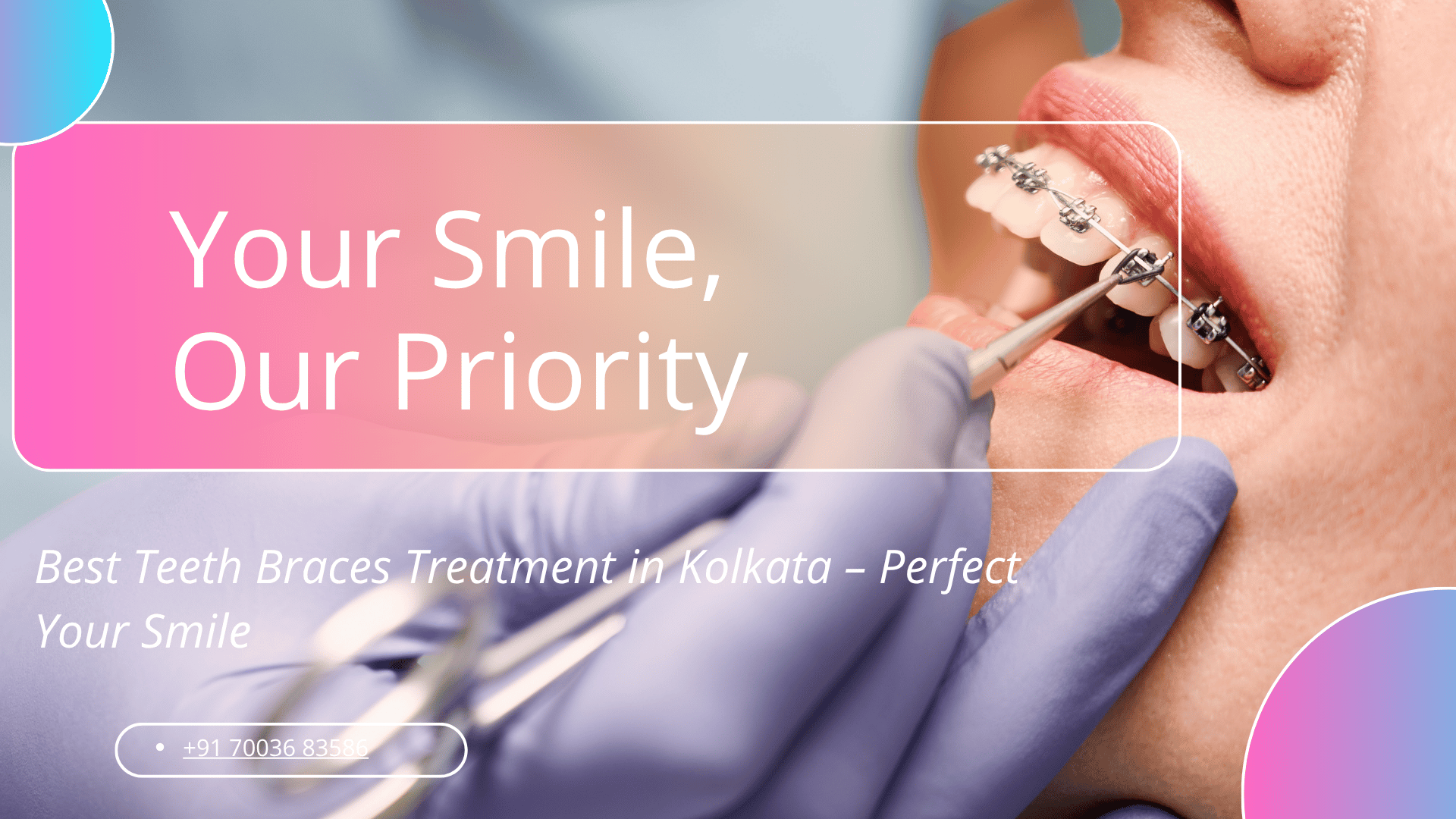 Teeth Braces Treatment