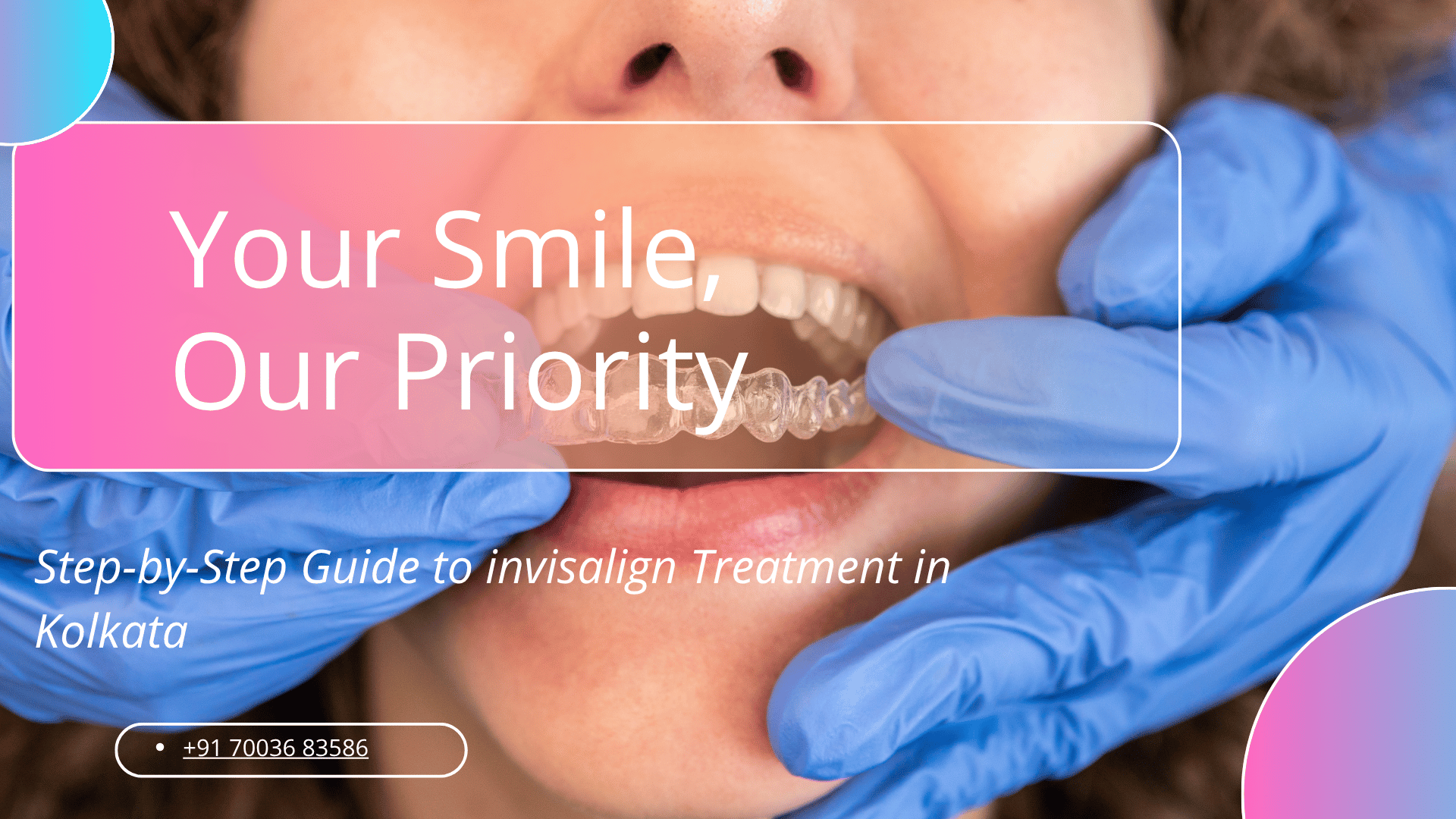 invisalign Treatment