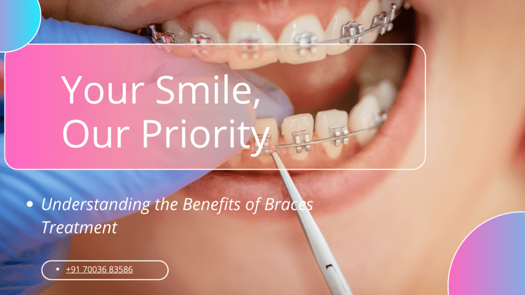 braces treatment