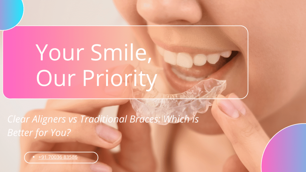 Clear Aligners vs Traditional Braces