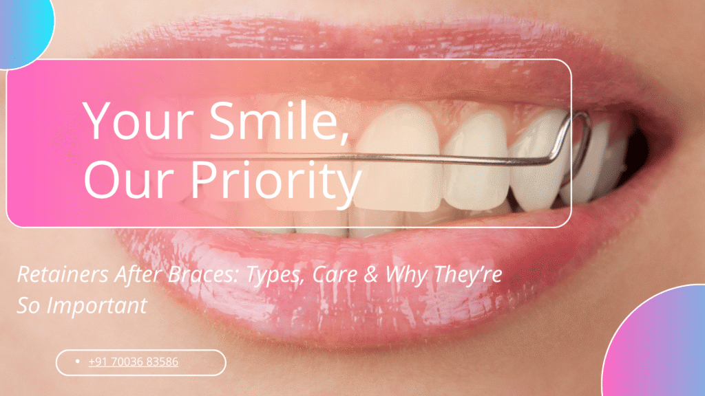 Retainers After Braces