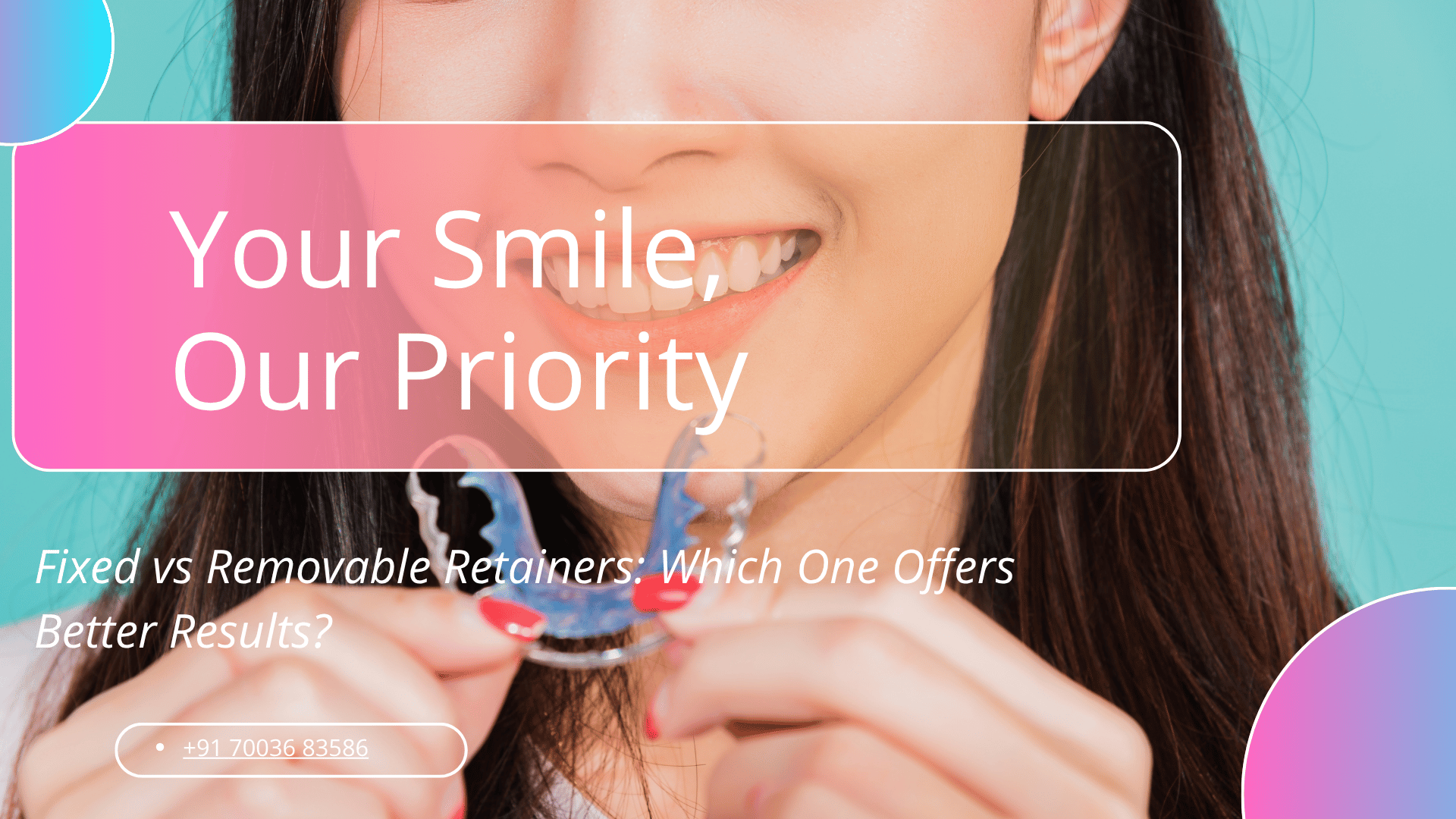 Fixed vs Removable Retainers