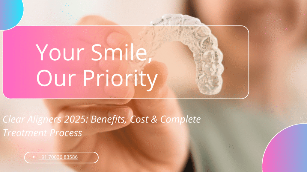 clear aligners