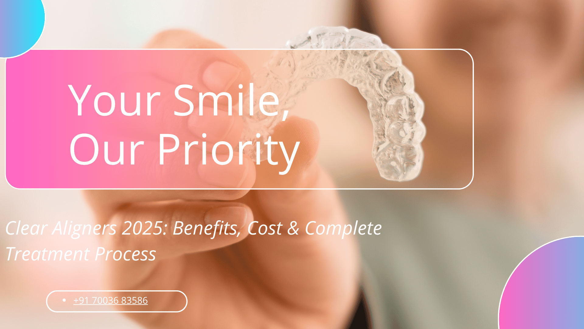 clear aligners