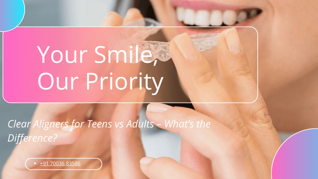 Clear Aligners