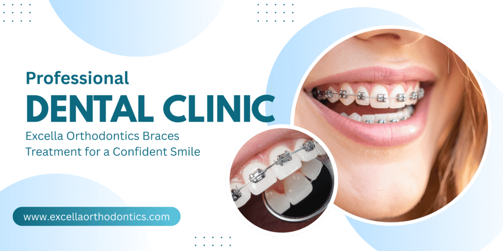 Braces Treatment