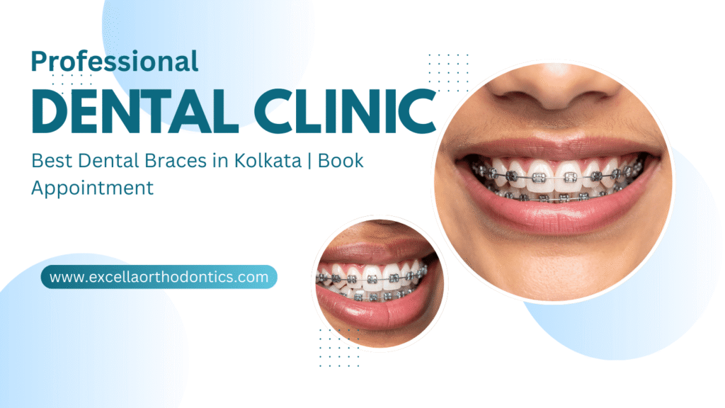Best Dental Braces in Kolkata