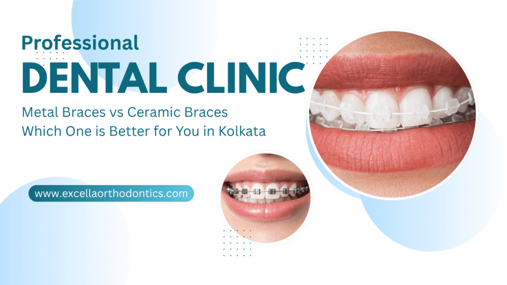 Metal Braces vs Ceramic Braces